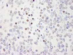 WRNIP1 Polyclonal Antibody, Bethyl Laboratories 100 &mu;L; Unconjugated:Antibodies,