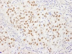 WRNIP1 Polyclonal Antibody, Bethyl Laboratories 100 &mu;L; Unconjugated:Antibodies,