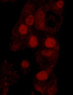 WRNIP1 Polyclonal Antibody, Bethyl Laboratories 100 &mu;L; Unconjugated:Antibodies,