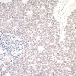 WSTF Rabbit anti-Human, Polyclonal, Bethyl Laboratories 100 &mu;L; Unconjugated:Antibodies,