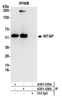 WTAP Rabbit anti-Human, Polyclonal, Bethyl Laboratories 100 &mu;L; Unconjugated:Antibodies,