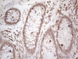 WTAP Mouse anti-Human, Clone: OTI6H3, lyophilized, TrueMAB 100 &mu;g; Unconjugated:Antibodies,