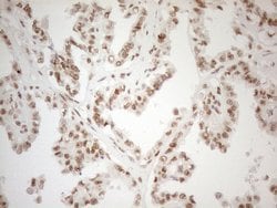 WTAP Monoclonal Antibody (OTI12G7), TrueMAB , OriGene 100 &mu;L; Unconjugated:Antibodies,