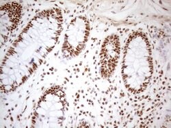 WTAP Monoclonal Antibody (OTI12G7), TrueMAB , OriGene 100 &mu;L; Unconjugated:Antibodies,