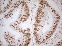 WTAP Monoclonal Antibody (OTI12G7), TrueMAB , OriGene 100 &mu;L; Unconjugated:Antibodies,