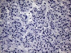 WTAP Monoclonal Antibody (OTI6C3), TrueMAB , OriGene 100 &mu;L; Unconjugated:Antibodies,