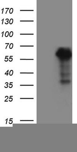 WTAP Monoclonal Antibody (OTI12G7), TrueMAB , OriGene 100 &mu;L; Unconjugated:Antibodies,