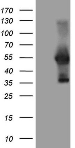 WTAP Monoclonal Antibody (OTI6C3), TrueMAB , OriGene 100 &mu;L; Unconjugated:Antibodies,