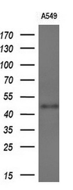 WWTR1 Monoclonal Antibody (OTI1B5), TrueMAB , OriGene 30 &mu;L; Unconjugated:Antibodies,