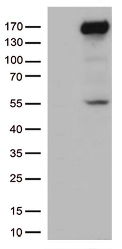 XDH Monoclonal Antibody (OTI1C10), TrueMAB , OriGene:Anticuerpos:Anticuerpos