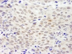 XLF Rabbit anti-Human, Polyclonal, Bethyl Laboratories 10 &mu;L; Unconjugated:Antibodies,