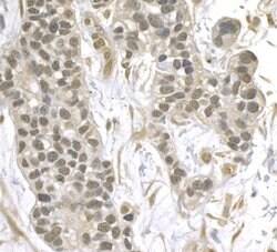 XPA Rabbit anti-Human, Polyclonal, Bethyl Laboratories 100 &mu;l; Unlabeled:Antibodies,