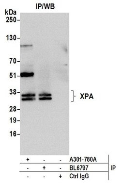 XPA Rabbit anti-Human, Polyclonal, Bethyl Laboratories 100 &mu;l; Unlabeled:Antibodies,