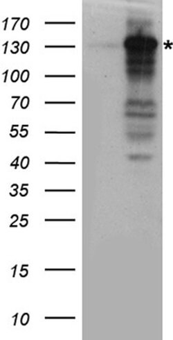 XPC Rabbit anti-Human, Mouse, Rat, Polyclonal, liquid, OriGene 100 &mu;L;