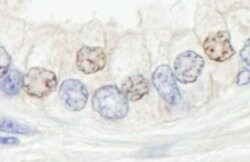 XPF/ERCC4 Rabbit anti-Human, Polyclonal, Bethyl Laboratories 100 &mu;l;
