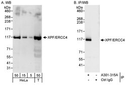 XPF/ERCC4 Rabbit anti-Human, Polyclonal, Bethyl Laboratories 100 &mu;l;