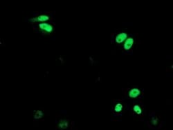 XPF Monoclonal Antibody (OTI6E6), TrueMAB , OriGene 100 &mu;L; Unconjugated:Antibodies,