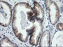 XPF Monoclonal Antibody (OTI6E6), TrueMAB , OriGene 100 &mu;L; Unconjugated:Antibodies,