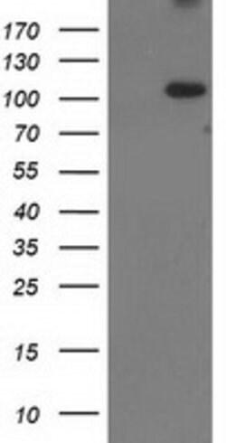XPF Mouse anti-Human, Clone: OTI2D4, lyophilized, TrueMAB 100 &mu;g; Unconjugated:Antibodies,