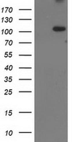 XPF Monoclonal Antibody (OTI2D4), TrueMAB , OriGene 100 &mu;L; Unconjugated:Antibodies,
