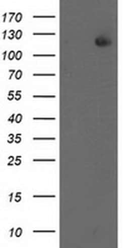 XPF Monoclonal Antibody (OTI6E6), TrueMAB , OriGene 100 &mu;L; Unconjugated:Antibodies,