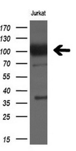 XPF Mouse anti-Human, Clone: OTI6E6, lyophilized, TrueMAB 100 &mu;g; Unconjugated:Antibodies,