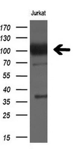 XPF Monoclonal Antibody (OTI6E6), TrueMAB , OriGene 100 &mu;L; Unconjugated:Antibodies,