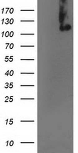 XPF Monoclonal Antibody (OTI2A1), TrueMAB , OriGene 100 &mu;L; Unconjugated:Antibodies,