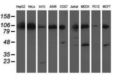 XPF Monoclonal Antibody (OTI2A1), TrueMAB , OriGene 100 &mu;L; Unconjugated:Antibodies,