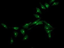 XPNPEP3 Monoclonal Antibody (OTI2D5), TrueMAB , OriGene:Antibodies:Primary
