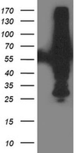 XPNPEP3 Monoclonal Antibody (OTI5G2), TrueMAB , OriGene 100 &mu;L; Unconjugated:Antibodies,