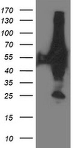 XPNPEP3 Monoclonal Antibody (OTI4B8), TrueMAB , OriGene 100 &mu;L; Unconjugated:Antibodies,
