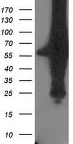 XPNPEP3 Monoclonal Antibody (OTI2D5), TrueMAB , OriGene 30 &mu;L; Unconjugated:Antibodies,