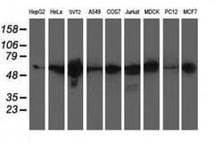 XPNPEP3 Monoclonal Antibody (OTI2D5), TrueMAB , OriGene 30 &mu;L; Unconjugated:Antibodies,