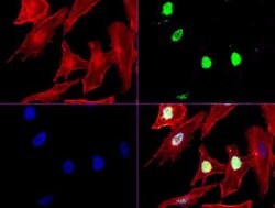 XRCC1 Mouse anti-Human, Clone: UMAB40, liquid, UltraMAB 30 &mu;L; Unconjugated:Antibodies,
