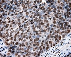 XRCC1 Mouse anti-Human, Clone: OTI2F8, lyophilized, TrueMAB 100 &mu;g;