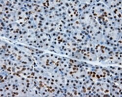 XRCC1 Mouse anti-Human, Clone: OTI2F8, lyophilized, TrueMAB 100 &mu;g;