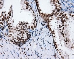 XRCC1 Mouse anti-Human, Clone: OTI2F8, lyophilized, TrueMAB 100 &mu;g;