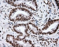 XRCC1 Mouse anti-Human, Clone: OTI2F8, lyophilized, TrueMAB 100 &mu;g;