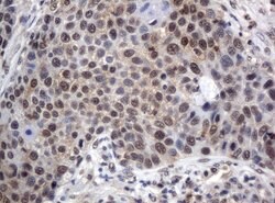 XRCC1 Mouse anti-Human, Clone: UMAB40, liquid, UltraMAB 30 &mu;L; Unconjugated:Antibodies,
