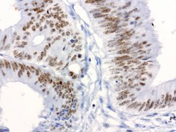 XRCC1 Mouse anti-Human, Clone: UMAB40, liquid, UltraMAB 30 &mu;L; Unconjugated:Antibodies,