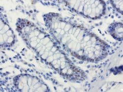 XRCC1 Mouse anti-Human, Clone: UMAB40, liquid, UltraMAB 30 &mu;L; Unconjugated:Antibodies,