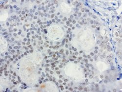 XRCC1 Mouse anti-Human, Clone: UMAB40, liquid, UltraMAB 30 &mu;L; Unconjugated:Antibodies,