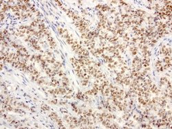 XRCC1 Mouse anti-Human, Clone: UMAB40, liquid, UltraMAB 30 &mu;L; Unconjugated:Antibodies,