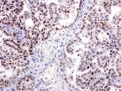 XRCC1 Mouse anti-Human, Clone: UMAB40, liquid, UltraMAB 30 &mu;L; Unconjugated:Antibodies,