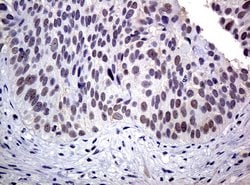 XRCC1 Mouse anti-Human, Clone: UMAB40, liquid, UltraMAB 30 &mu;L; Unconjugated:Antibodies,