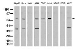 XRCC1 Mouse anti-Human, Clone: UMAB40, liquid, UltraMAB 30 &mu;L; Unconjugated:Antibodies,