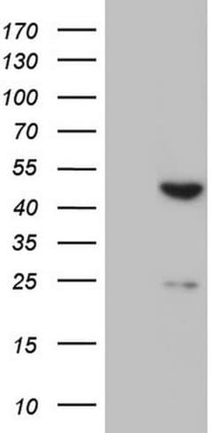 XRCC3 Monoclonal Antibody (OTI4F3), TrueMAB , OriGene:Antibodies:Primary