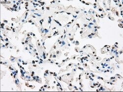 XRCC4 Mouse anti-Human, Clone: OTI4H9, lyophilized, TrueMAB 100 &mu;g;