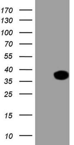 XRCC6BP1 Mouse anti-Human, Clone: OTI5F3, liquid, TrueMAB 100 &mu;L; Unconjugated:Antibodies,